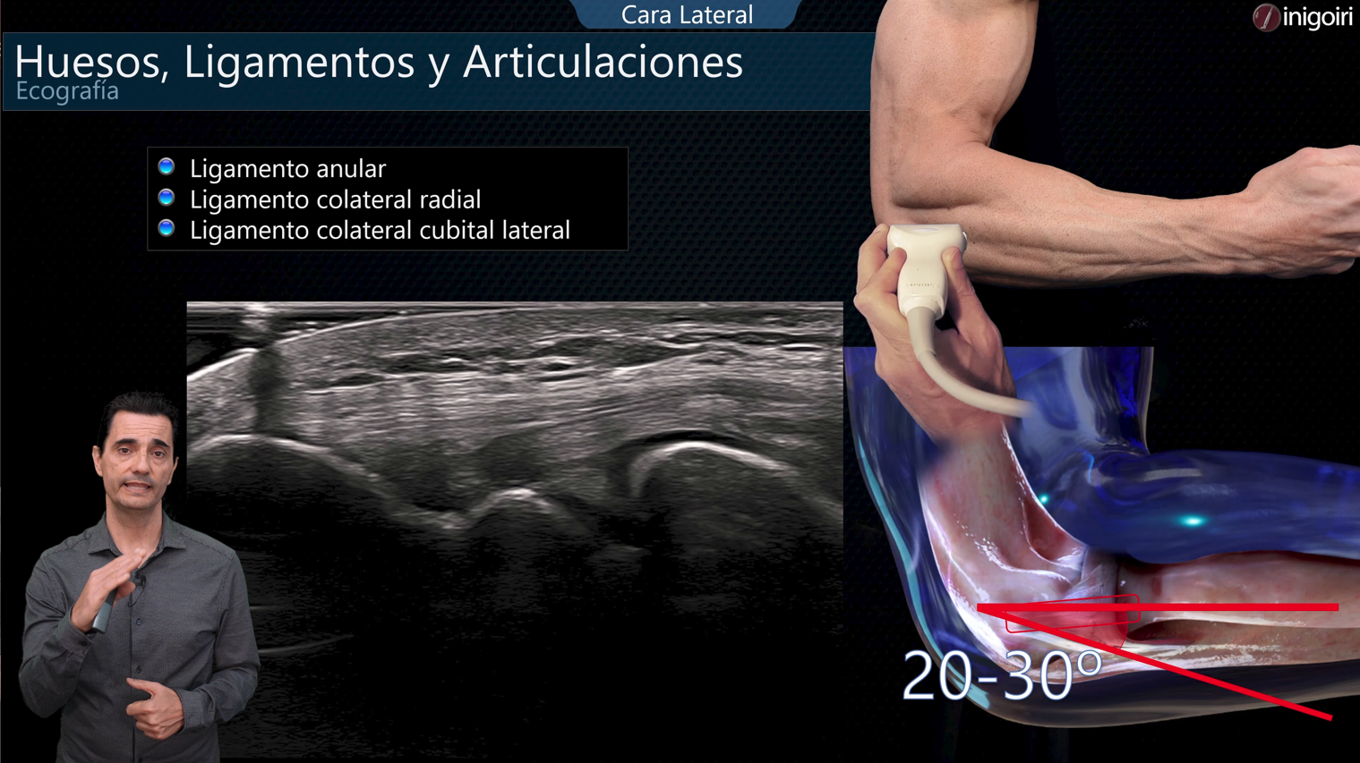 Doppler en Ecografía Musculoesquelética 2